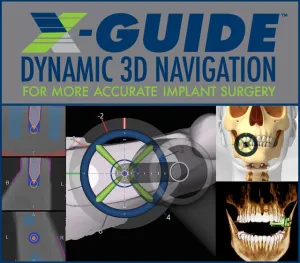 X-Guide 3D Navigation System